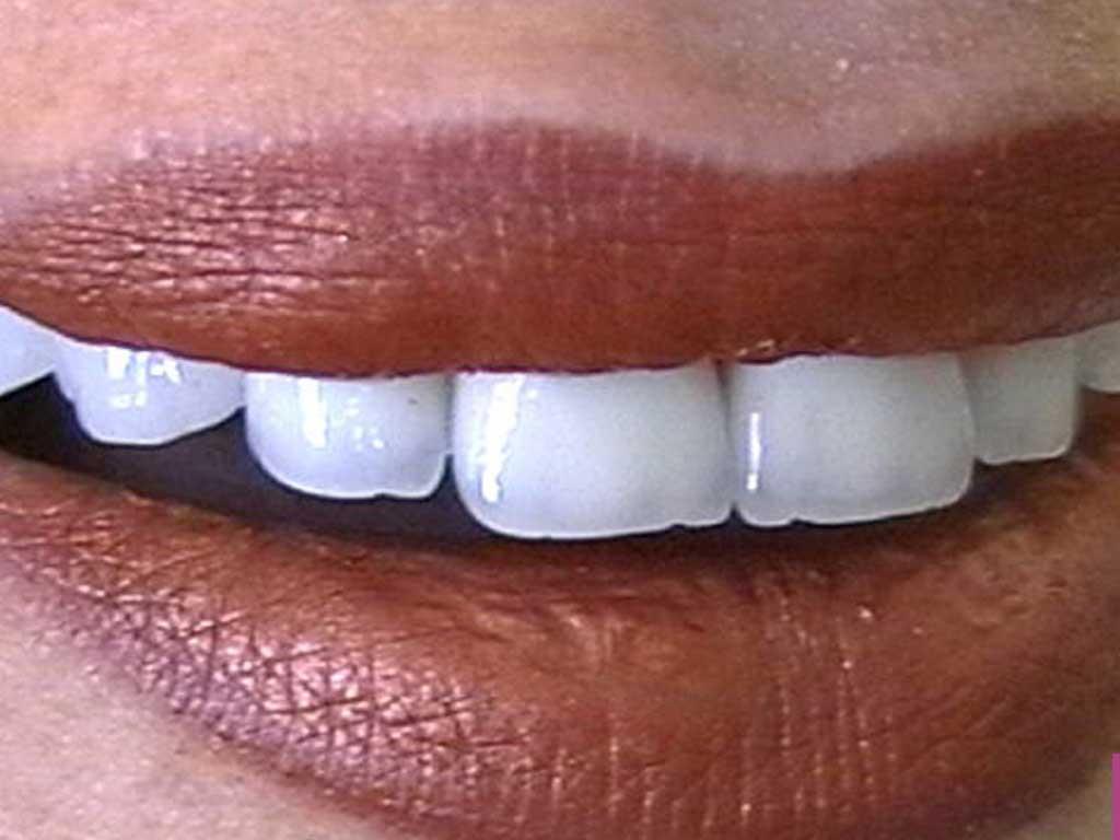Kozmetik Diş Hekimliği
