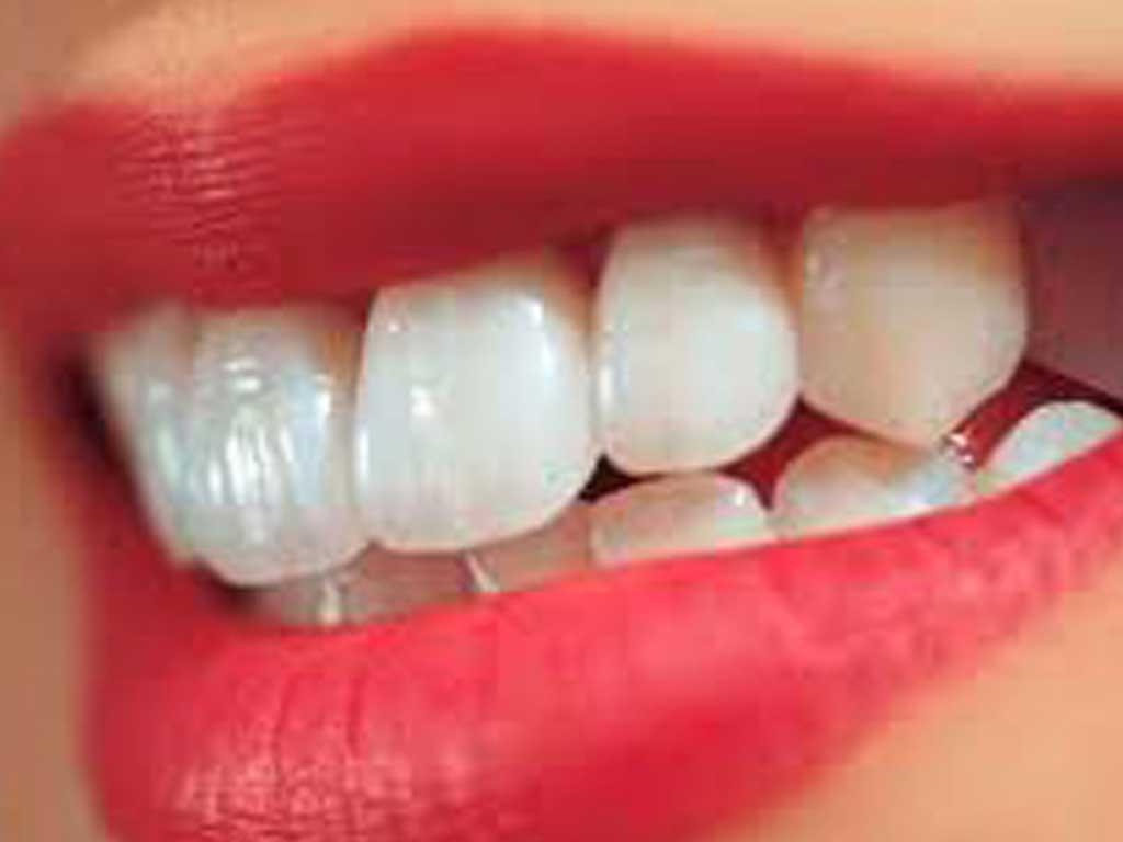 Estetik Diş